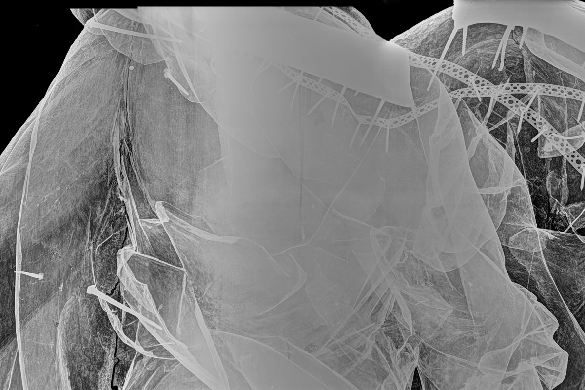 Ängel i Hedvig Elenora kyrka röntgen